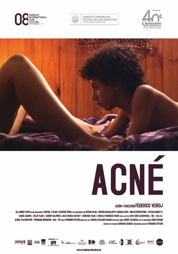 Смотреть Угри онлайн в HD качестве 720p
